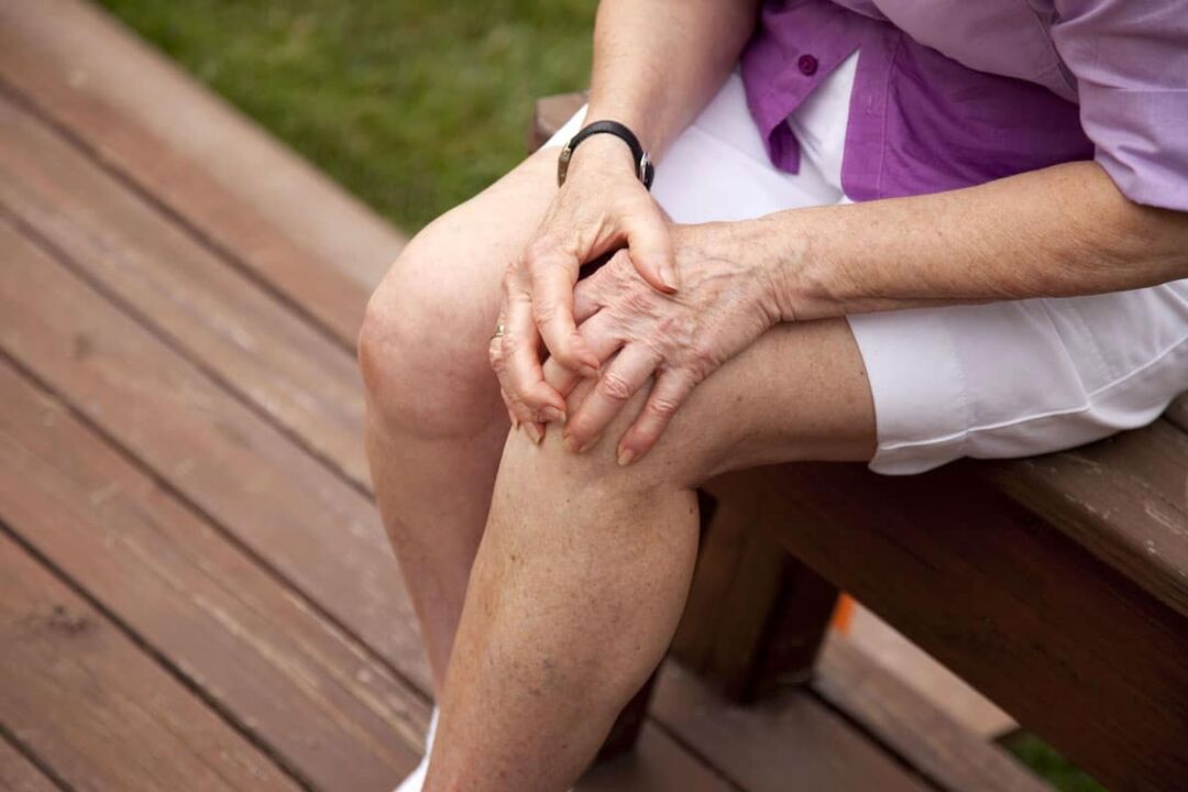Arthrose tritt am häufigsten bei älteren Menschen auf