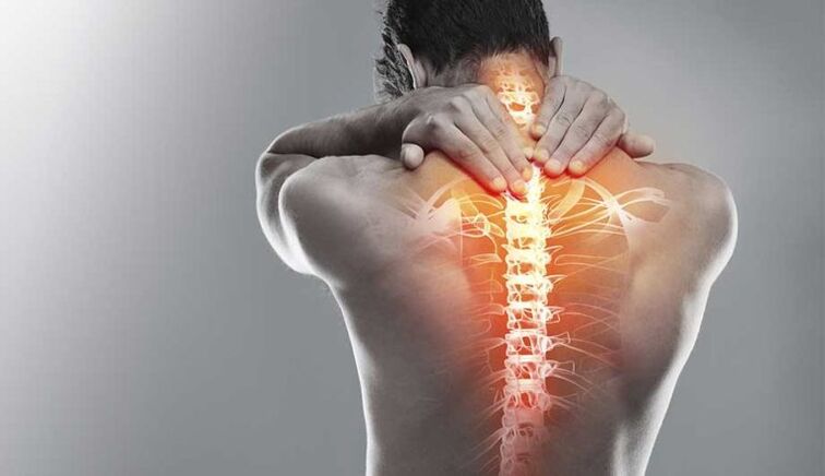 Starke Schmerzen in der Mitte des Rückens - ein Zeichen für eine Schädigung der Wirbelsäule