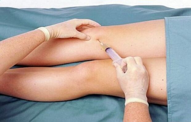 Der Grad der Arthrose des Kniegelenks