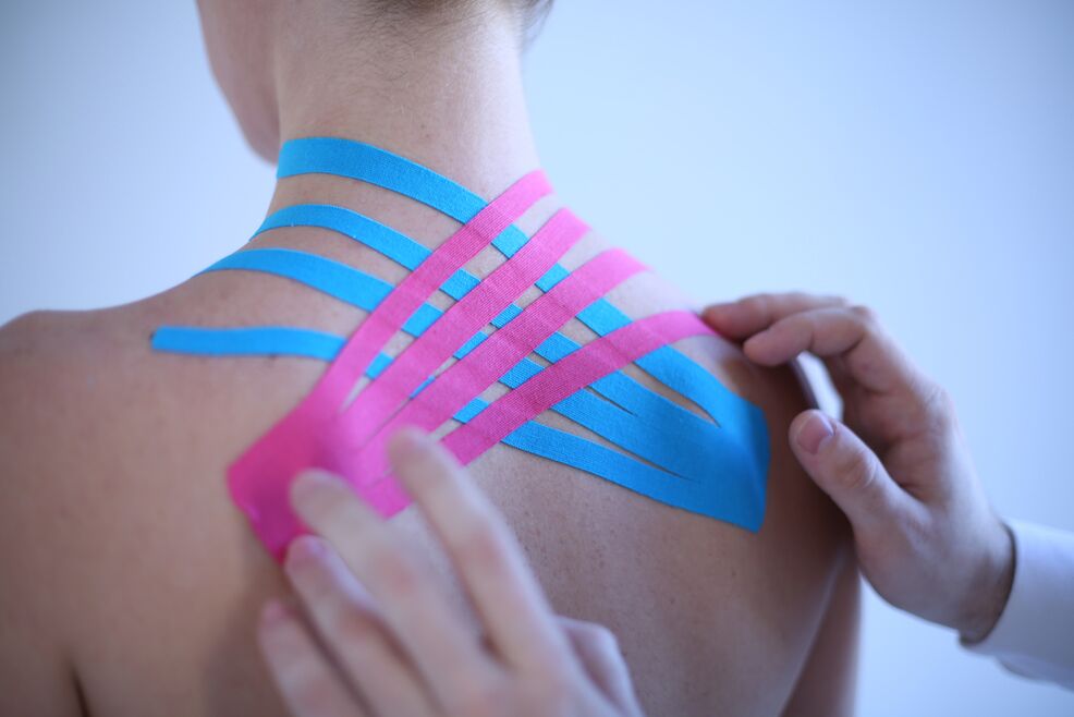 Kinesiotaping bei spinaler Osteochondrose