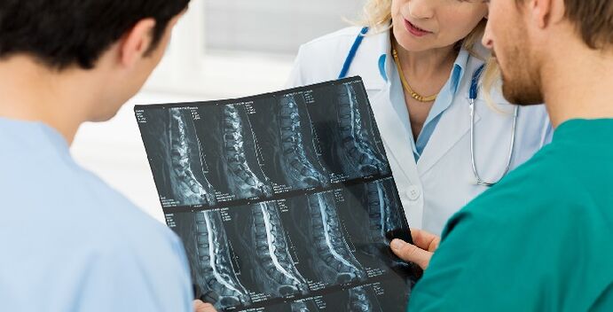 Röntgen der Wirbelsäule zur Diagnose von Osteochondrose