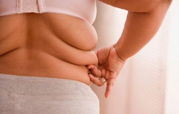 Übergewicht, die Ursache für zervikale Osteochondrose bei Frauen unter 40 Jahren