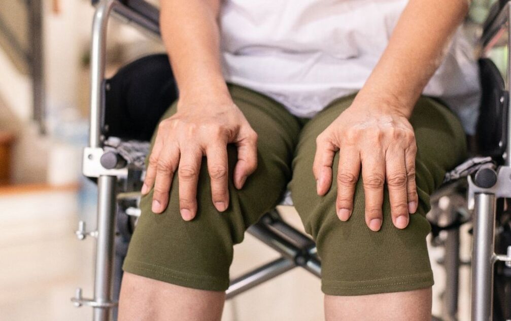 Ein Patient mit Arthrose der Kniegelenke